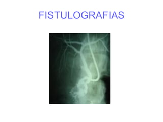 FISTULOGRAFIAS
 