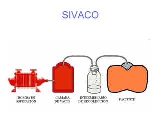 SIVACO
 