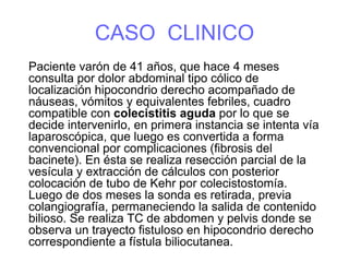 CASO CLINICO
Paciente varón de 41 años, que hace 4 meses
consulta por dolor abdominal tipo cólico de
localización hipocondrio derecho acompañado de
náuseas, vómitos y equivalentes febriles, cuadro
compatible con colecistitis aguda por lo que se
decide intervenirlo, en primera instancia se intenta vía
laparoscópica, que luego es convertida a forma
convencional por complicaciones (fibrosis del
bacinete). En ésta se realiza resección parcial de la
vesícula y extracción de cálculos con posterior
colocación de tubo de Kehr por colecistostomía.
Luego de dos meses la sonda es retirada, previa
colangiografía, permaneciendo la salida de contenido
bilioso. Se realiza TC de abdomen y pelvis donde se
observa un trayecto fistuloso en hipocondrio derecho
correspondiente a fístula biliocutanea.
 