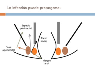 La infección puede propagarse:



                 Espacio
                pelvirrectal



                               Pared
                               rectal

    Fosa
isquiorrectal



                                Margen
                                 anal
 