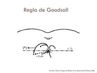 Regla de Goodsall




         Ferraina P, Oría A. Cirugía de Michans 5ª ed., Buenos Aires: El Ateneo, 2002.
 