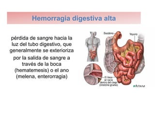 Hemorragia digestiva alta

pérdida de sangre hacia la
 luz del tubo digestivo, que
generalmente se exterioriza
  por la salida de sangre a
      través de la boca
   (hematemesis) o el ano
    (melena, enterorragia)
 