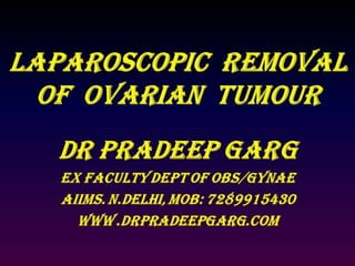 Laparoscopic Removal Of Ovarian Tumour : Dr Pradeep Garg