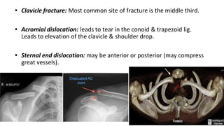 acromioclavicular joint , shoulder joint , sternoclavicular joint | PDF