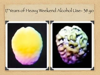 17 Years of Heavy Weekend Alcohol Use- 38 yo
 