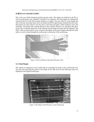 Electrocardiogram Tip Confirmation System.pdf Designing A 3-Lead Cost Effective Ecg Recording Glove For Home ...