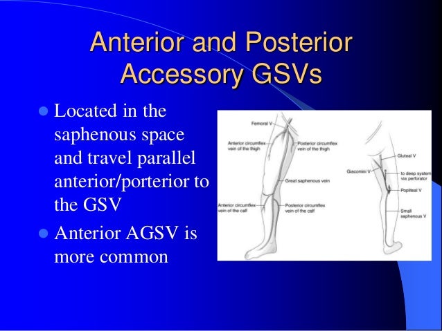 THE MIGHTY GSV2
