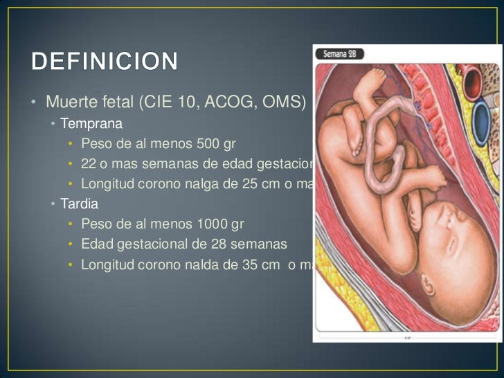 Manejo del óbito fetal intrauterino - CICAT-SALUD Manejo del óbito fetal intrauterino - CICAT-SALUD
