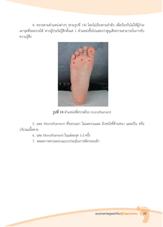 แนวทางการดูแลเท้าในผู้ป่วยเบาหวาน