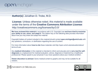 Author(s): Jonathan D. Trobe, M.D.

License: Unless otherwise noted, this material is made available
under the terms of the Creative Commons Attribution License:
http://creativecommons.org/licenses/by/3.0/
We have reviewed this material in accordance with U.S. Copyright Law and have tried to maximize
your ability to use, share, and adapt it. The citation key on the following slide provides information
about how you may share and adapt this material.

Copyright holders of content included in this material should contact open.michigan@umich.edu with
any questions, corrections, or clarification regarding the use of content.

For more information about how to cite these materials visit http://open.umich.edu/education/about/
terms-of-use.

Any medical information in this material is intended to inform and educate and is not a tool for self-
diagnosis or a replacement for medical evaluation, advice, diagnosis or treatment by a healthcare
professional. Please speak to your physician if you have questions about your medical condition.

Viewer discretion is advised: Some medical content is graphic and may not be suitable for all
viewers.
 