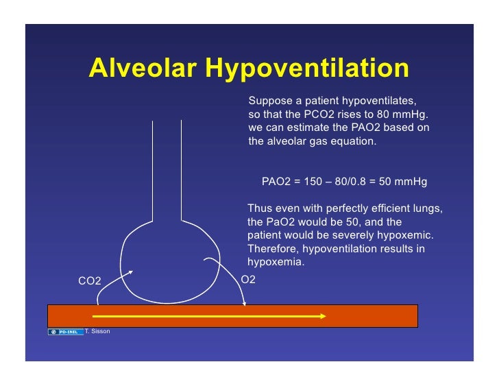 11.19.08 Ventilation/Perfusion Matching