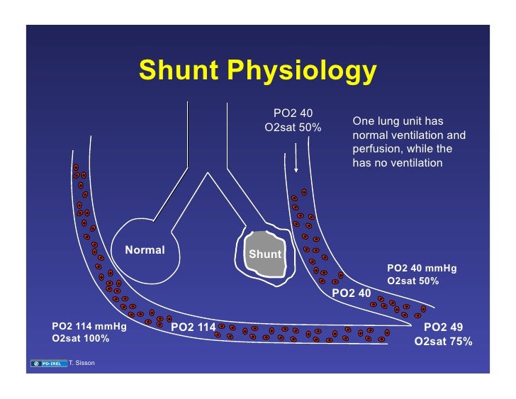 11.19.08 Ventilation/Perfusion Matching