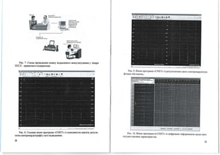 І НТtІ>ІІtт· 'h
"NJteфшotttfl'ta1
•·,.,.".
Jfit..-:tJ....,"1ж(~·_,.,,,.,.нr
)'llilltp(lfТ'rt(I.J.70f .1"iJ.7~1111i
Рис. 7. Схема проведення сеансу віддаленого консульrування у лікаря
ЗПСЛ- приватного підприємця.
n >1- ..., ~~~ ~ ~ с- .
~ ..:І У .. - 's_;" t. V
Рис. 8. Головне вікно програми «UNET» із моЖJШВістю аналізу резуль­
татів елеюрокардіоrрафіїу всіх відведеннях.
28
Рис. 9. Вікно програми «UNET» із результатами двох електрокардіогра­
фічних обстежень.
Рис. 10. Вікно програми f«<UNET» із цифровою інформацією щодо амп­
літудно-часових характеристик.
29
 