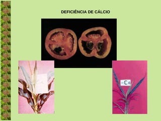 DEFICIÊNCIA DE CÁLCIO
 