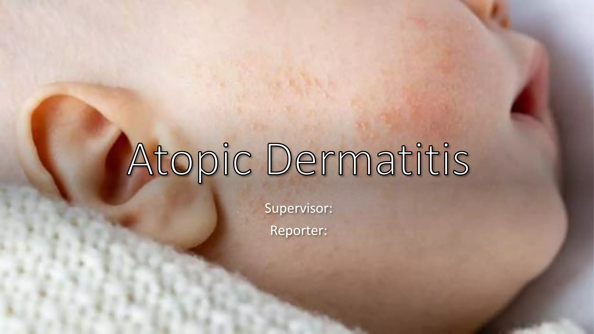 小兒異位性皮膚炎.pptx