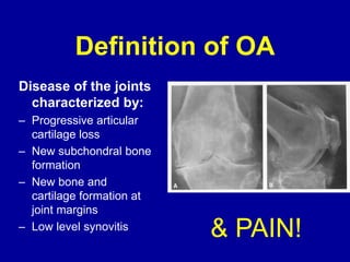 Disease of the joints
characterized by:
– Progressive articular
cartilage loss
– New subchondral bone
formation
– New bone and
cartilage formation at
joint margins
– Low level synovitis
Definition of OA
& PAIN!
 