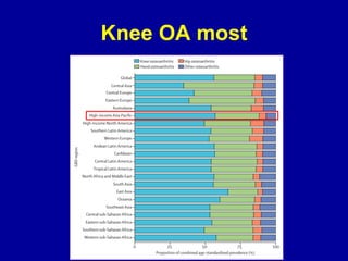 Knee OA most
 