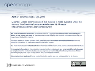 Author: Jonathan Trobe, MD, 2009

License: Unless otherwise noted, this material is made available under the
terms of the Creative Commons Attribution 3.0 License:
http://creativecommons.org/licenses/by/3.0/


We have reviewed this material in accordance with U.S. Copyright Law and have tried to maximize your
ability to use, share, and adapt it. The citation key on the following slide provides information about how you
may share and adapt this material.

Copyright holders of content included in this material should contact open.michigan@umich.edu with any
questions, corrections, or clarification regarding the use of content.

For more information about how to cite these materials visit http://open.umich.edu/education/about/terms-of-use.

Any medical information in this material is intended to inform and educate and is not a tool for self-diagnosis
or a replacement for medical evaluation, advice, diagnosis or treatment by a healthcare professional. Please
speak to your physician if you have questions about your medical condition.

Viewer discretion is advised: Some medical content is graphic and may not be suitable for all viewers.
 
