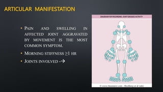 ARTICULAR MANIFESTATION
• PAIN AND SWELLING IN
AFFECTED JOINT AGGRAVATED
BY MOVEMENT IS THE MOST
COMMON SYMPTOM.
• MORNING STIFFNESS ≥1 HR
• JOINTS INVOLVED -
 