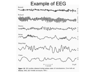 Example of EEG
 