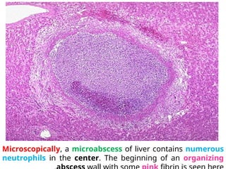 grose pathology of human organ system.pptx