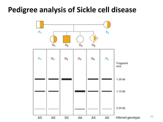 42
Pedigree analysis of Sickle cell disease
 