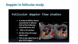 Doppler in follicular study
 