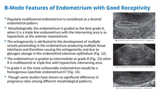 B-Mode Features of Endometrium with Good Receptivity
 Popularly multilayered endometrium is considered as a desired
endometrial pattern.
 Morphologically, the endometrium is graded as the best grade A,
when it is a triple line endometrium with the intervening area is as
hypoechoic as the anterior myometrium.
 The echogenecity is attributed to the development of multiple
vessels penetrating in the endometrium producing multiple tissue
interfaces and therefore causing the echogenecity and due to
glycogen storage in the endometrial columnar epithelium (Fig. 12).
 The endometrium is graded as intermediate or grade B (Fig. 13) when
it is multilayered or triple line with hypoechoic intervening area.
 In grade C or the most unfavorable endometrium would be a
homogenous isoechoic endometrium17 (Fig. 14).
 Though some studies have shown no significant difference in
pregnancy rates among different morphological patterns.
 
