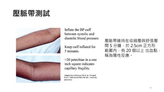 壓脈帶測試
29
壓脈帶維持在收縮壓與舒張壓
間 5 分鐘，於 2.5cm 正方形
範圍內，有 20 個以上 出血點，
稱為陽性反應。
 