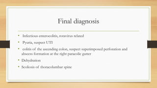 Final diagnosis
• Infectious enterocolitis, rotavirus related
• Pyuria, suspect UTI
• colitis of the ascending colon, suspect superimposed perforation and
abscess formation at the right paracolic gutter
• Dehydration
• Scoliosis of thoracolumbar spine
 