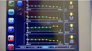 Pulse Contour Analysis: Riding the Wave | PPTX