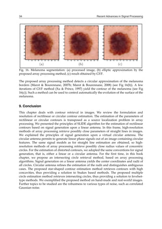 Recent Advances in Signal Processing
34
Fig. 16. Melanoma segmentation: (a) processed image, (b) elliptic approximation by the
proposed array processing method, (c) result obtained by GVF.
The proposed array processing method detects a circular approximation of the melanoma
borders (Marot & Bourennane, 2007b; Marot & Bourennane, 2008) (see Fig 16(b)). A few
iterations of GVF method (Xu & Prince, 1997) yield the contour of the melanoma (see Fig
16(c)). Such a method can be used to control automatically the evolution of the surface of the
melanoma.
9. Conclusion
This chapter deals with contour retrieval in images. We review the formulation and
resolution of rectilinear or circular contour estimation. The estimation of the parameters of
rectilinear or circular contours is transposed as a source localization problem in array
processing. We presented the principles of SLIDE algorithm for the estimation of rectilinear
contours based on signal generation upon a linear antenna. In this frame, high-resolution
methods of array processing retrieve possibly close parameters of straight lines in images.
We explained the principles of signal generation upon a virtual circular antenna. The
circular antenna permits to generate linear phase signals out of an image containing circular
features. The same signal models as for straight line estimation are obtained, so high-
resolution methods of array processing retrieve possibly close radius values of concentric
circles. For the estimation of distorted contours, we adopted the same conventions for signal
generation, that is, either a linear or a circular antenna. For the first time, in this book
chapter, we propose an intersecting circle retrieval method, based on array processing
algorithms. Signal generation on a linear antenna yields the center coordinates and radii of
all circles. Circular antenna refines the estimation of the radii and distinguishes ambiguous
cases. The proposed star-shaped contour estimation method retrieves contours with high
concavities, thus providing a solution to Snakes based methods. The proposed multiple
circle estimation method retrieves intersecting circles, thus providing a solution to levelset-
type methods. We exemplified the proposed method on hand-made and real-world images.
Further topics to be studied are the robustness to various types of noise, such as correlated
Gaussian noise.
 