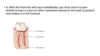 • 4. After the final visit with your endodontist, you must return to your
dentist to have a crown or other restoration placed on the tooth to protect
and restore it to full function
 