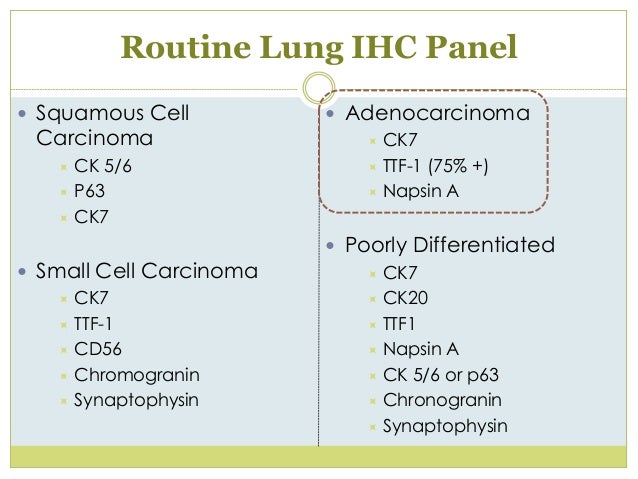 Nsclungca Nsclungca