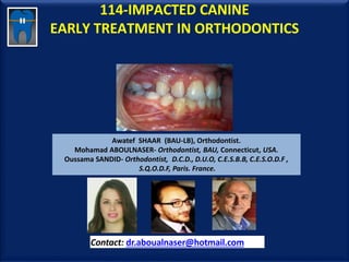 114-IMPACTED CANINE
EARLY TREATMENT IN ORTHODONTICS
Awatef SHAAR (BAU-LB), Orthodontist.
Mohamad ABOULNASER- Orthodontist, BAU, Connecticut, USA.
Oussama SANDID- Orthodontist, D.C.D., D.U.O, C.E.S.B.B, C.E.S.O.D.F ,
S.Q.O.D.F, Paris. France.
Contact: dr.aboualnaser@hotmail.com
www.orthofree.com
 