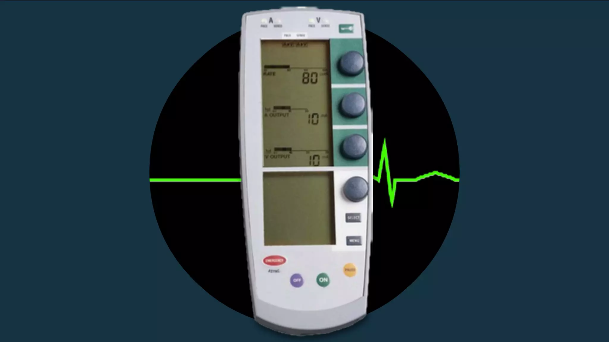 A Revised Algorithm for PEA Cardiac Arrest: Haney Mallemat | PPT | Free ...