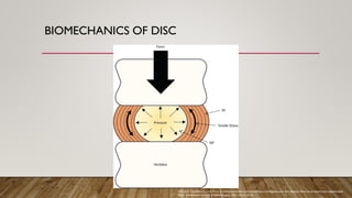 BIOMECHANICS OF DISC
Kirnaz S, Capadona C, Lintz M, et al. Pathomechanism and biomechanics of degenerative disc disease: features of healthy and degenerated
discs. International Journal of Spine Surgery. 2021;15(s1):10-25.
 