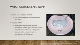 WHAT IS DISCOGENIC PAIN?
• Inman and Saunders in 1947:
• Pain originating from the intervertebral
disc itself
• Crock in 1970 :
• Internal disc disruption to describe
unremitting lumbar spinal pain that lasted
longer than 4 months, was unresponsive
to conservative care, and could be
reproduced with discography
Calodney, A., & Buchalter, J. (2011). 1 Epidemiology and Etiology of Discogenic Pain: How Big Is the Problem?. Diagnosis, Management,
and Treatment of Discogenic Pain E-Book: Volume 3: A Volume in the Interventional and Neuromodulatory Techniques for Pain
Management Series; Expert Consult Premium Edition--Enhanced Online Features, 1.
Lorio MP, Beall DP, Calodney AK, Lewandrowski KU, Block JE, Mekhail N. Defining the patient with lumbar discogenic pain: real-world
implications for diagnosis and effective clinical management. JPM. 2023;13(5):821.
 