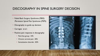 DISCOGRAPHY IN SPINE SURGERY DECISION
• Failed Back Surgery Syndrome (FBSS)
/Persistent Spinal Pain Syndrome (PSPS)
• Discography to guide op decision
• Carragee et al :
• Positive pain response in discography:
• Pain-free group : 10%
• Chronic cervical pain : 40%
• Somatization disorder : 83%
https://drjimmyw.com/%E8%85%B0%E6%A4%8E%E8%A1%93%E5%BE%8C%E7%96%BC%E7%97%9B%E7%97%87%E5%80%99%E7%BE%A4-fbss/
Carragee EJ, Tanner CM, Khurana S, et al. The rates of false-positive lumbar discography in select patients without low back symptoms: Spine.
2000;25(11):1373-1381.
 