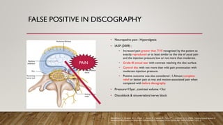 FALSE POSITIVE IN DISCOGRAPHY
• Neuropathic pain : Hyperalgesia
• IASP (2009) :
• Increased pain greater than 7/10 recognized by the patient as
exactly reproduced or at least similar to the site of usual pain
and the injection pressure low or not more than moderate.
• Grade III annual tear with contrast reaching the disc surface.
• Control disc with not more than mild pain provocation with
moderate injection pressure.
• Positive outcome was also considered : 1.Almost complete
relief or better pain at rest and motion-associated pain when
compared with before discography.
• Pressure<15psi , contrast volume <3cc
• Discoblock & sinuvertebral nerve block
PAIN
Manchikanti, L., Boswell, M. V., Singh, V., Derby, R., Fellows, B., Falco, F., ... & Hirsch, J. A. (2009). Comprehensive review of
neurophysiologic basis and diagnostic interventions in managing chronic spinal pain. Pain Physician, 12(4), E71.
 