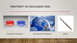 TREATMENT OF DISCOGENIC PAIN
W.carter. English: Red and Blue Pill as in the Matrix. The Original Photo Is of Two Yellow Omega-3 Capsules, Placed on a Grainy Paper on a
Windowsill. Light All Natural from the Window. Processed in Photoshop for Color. Photographed in Visby, Gotland, Sweden.; 2014.
Find pain relief that lasts | pain management in florida.
Nonoperative Management Interventional Pain Management Surgery
 