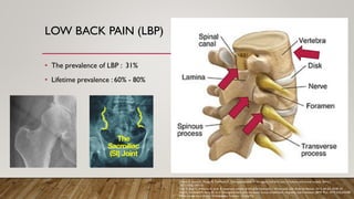 LOW BACK PAIN (LBP)
• The prevalence of LBP : 31%
• Lifetime prevalence : 60% - 80%
Ohtori S, Inoue G, Miyagi M, Takahashi K. Pathomechanisms of discogenic low back pain in humans and animal models. Spine J.
2015;15(6):1347–55.
Hoy D, Bain C, Williams G, et al. A systematic review of the global prevalence of low back pain. Arthritis Rheum. 2012; 64 (6): 2028–37.
Fujii K, Yamazaki M, Kang JD, et al. Discogenic back pain: literature review of definition, diagnosis, and treatment. JBMR Plus. 2019;3(5):e10180.
What causes hip arthritis? Orthopaedics Toronto - OrthoTO.
 