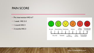 PAIN SCORE
• Pre interventionVAS 6-7
• 1 week VAS 2-3
• 1 monthVAS 3
• 3 monthsVAS 3
http://12345678910.com/
 
