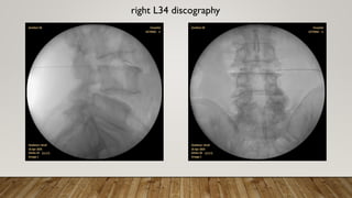 right L34 discography
 