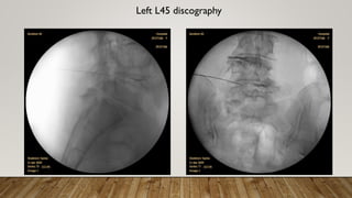Left L45 discography
 