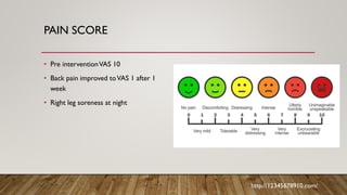 PAIN SCORE
• Pre interventionVAS 10
• Back pain improved toVAS 1 after 1
week
• Right leg soreness at night
http://12345678910.com/
 