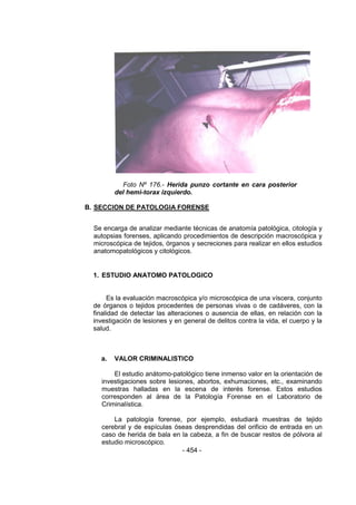 - 454 - 
Foto Nº 176.- Herida punzo cortante en cara posterior del hemi-torax izquierdo. 
B. SECCION DE PATOLOGIA FORENSE 
Se encarga de analizar mediante técnicas de anatomía patológica, citología y autopsias forenses, aplicando procedimientos de descripción macroscópica y microscópica de tejidos, órganos y secreciones para realizar en ellos estudios anatomopatológicos y citológicos. 
1. ESTUDIO ANATOMO PATOLOGICO 
Es la evaluación macroscópica y/o microscópica de una víscera, conjunto de órganos o tejidos procedentes de personas vivas o de cadáveres, con la finalidad de detectar las alteraciones o ausencia de ellas, en relación con la investigación de lesiones y en general de delitos contra la vida, el cuerpo y la salud. 
a. VALOR CRIMINALISTICO 
El estudio anátomo-patológico tiene inmenso valor en la orientación de investigaciones sobre lesiones, abortos, exhumaciones, etc., examinando muestras halladas en la escena de interés forense. Estos estudios corresponden al área de la Patología Forense en el Laboratorio de Criminalística. 
La patología forense, por ejemplo, estudiará muestras de tejido cerebral y de espículas óseas desprendidas del orificio de entrada en un caso de herida de bala en la cabeza, a fin de buscar restos de pólvora al estudio microscópico.  