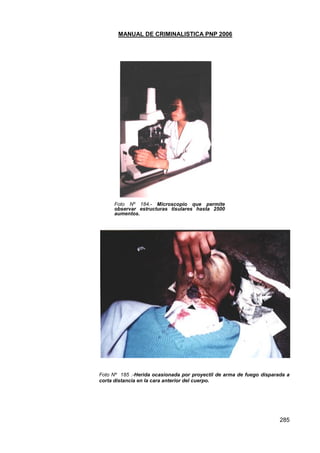 MANUAL DE CRIMINALISTICA PNP 2006 
285 
Foto Nº 184.- Microscopio que permite observar estructuras tisulares hasta 2500 aumentos. 
Foto Nº 185 .-Herida ocasionada por proyectil de arma de fuego disparada a corta distancia en la cara anterior del cuerpo. 
 