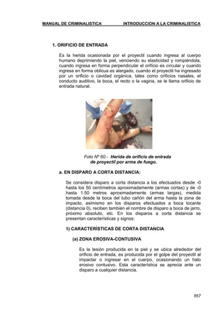 MANUAL DE CRIMINALISTICA INTRODUCCION A LA CRIMINALISTICA 
857 
1. ORIFICIO DE ENTRADA 
Es la herida ocasionada por el proyectil cuando ingresa al cuerpo humano deprimiendo la piel, venciendo su elasticidad y rompiéndola, cuando ingresa en forma perpendicular el orificio es circular y cuando ingresa en forma oblicua es alargado, cuando el proyectil ha ingresado por un orificio o cavidad orgánica, tales como orificios nasales, el conducto auditivo, la boca, el recto o la vagina, se le llama orificio de entrada natural. 
Foto Nº 60.- Herida de orificio de entrada 
de proyectil por arma de fuego. 
a. EN DISPARO A CORTA DISTANCIA: 
Se considera disparo a corta distancia a los efectuados desde -0 hasta los 50 centímetros aproximadamente (armas cortas) y de -0 hasta 1.50 metros aproximadamente (armas largas), medida tomada desde la boca del tubo cañón del arma hasta la zona de impacto, asimismo en los disparos efectuados a boca tocante (distancia 0), reciben también el nombre de disparo a boca de jarro, próximo absoluto, etc. En los disparos a corta distancia se presentan características y signos: 
1) CARACTERÍSTICAS DE CORTA DISTANCIA 
(a) ZONA EROSIVA-CONTUSIVA 
Es la lesión producida en la piel y se ubica alrededor del orificio de entrada, es producida por el golpe del proyectil al impactar o ingresar en el cuerpo, ocasionando un halo erosivo contusivo. Esta característica se aprecia ante un disparo a cualquier distancia. 
 