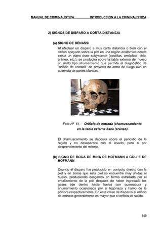 MANUAL DE CRIMINALISTICA INTRODUCCION A LA CRIMINALISTICA 
859 
2) SIGNOS DE DISPARO A CORTA DISTANCIA 
(a) SIGNO DE BENASSI 
Al efectuar un disparo a muy corta distancia o bien con el cañón apoyado sobre la piel en una región anatómica donde exista un plano óseo subyacente (costillas, omóplato, tibia, cráneo, etc.), se producirá sobre la tabla externa del hueso un anillo tipo ahumamiento que permite el diagnóstico de "orificio de entrada" de proyectil de arma de fuego aún en ausencia de partes blandas. 
Foto Nº 61.- Orificio de entrada (chamuscamiento 
en la tabla externa ósea (cráneo). 
El chamuscamiento se deposita sobre el periostio de la región y no desaparece con el lavado, pero si por desprendimiento del mismo. 
(b) SIGNO DE BOCA DE MINA DE HOFMANN ó GOLPE DE HOFMANN 
Cuando el disparo fue producido en contacto directo con la piel y en zonas que esta piel se encuentre muy unidas al hueso, produciendo desgarros en forma estrellada por el entallamiento de la piel después de haber ingresado los gases (de dentro hacia fuera) con quemadura y ahumamiento ocasionada por el fogonazo y humo de la pólvora respectivamente. En esta clase de disparos el orificio de entrada generalmente es mayor que el orificio de salida. 
 